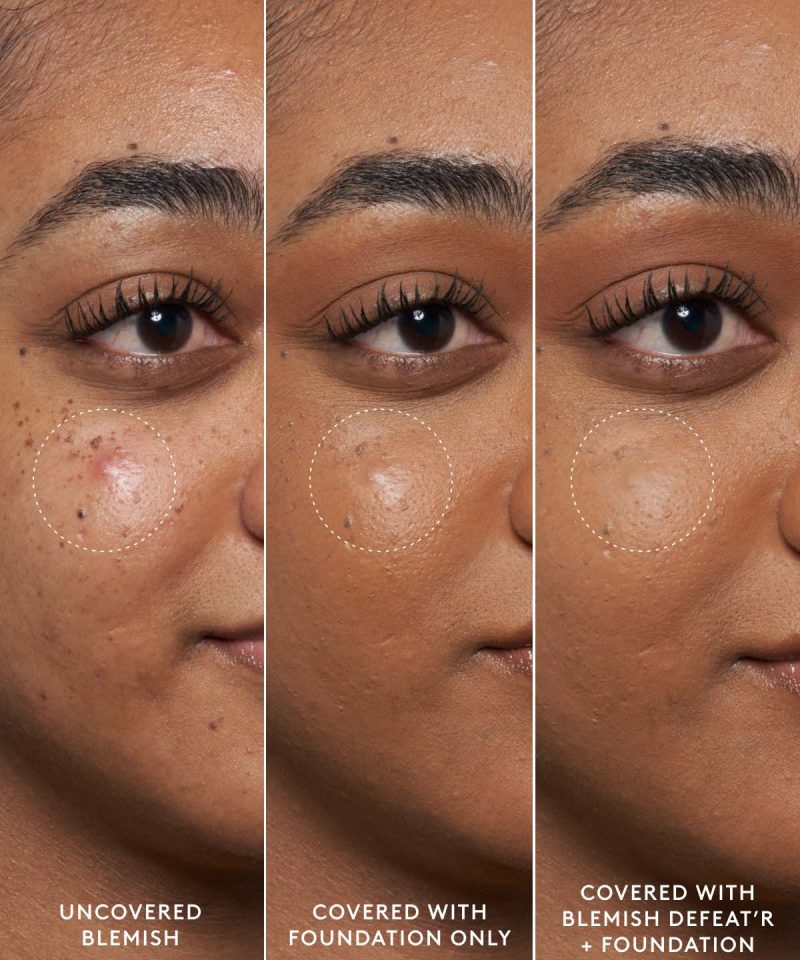 Alternative view of Blemish Defeat'r BHA Spot-Targeting Gel