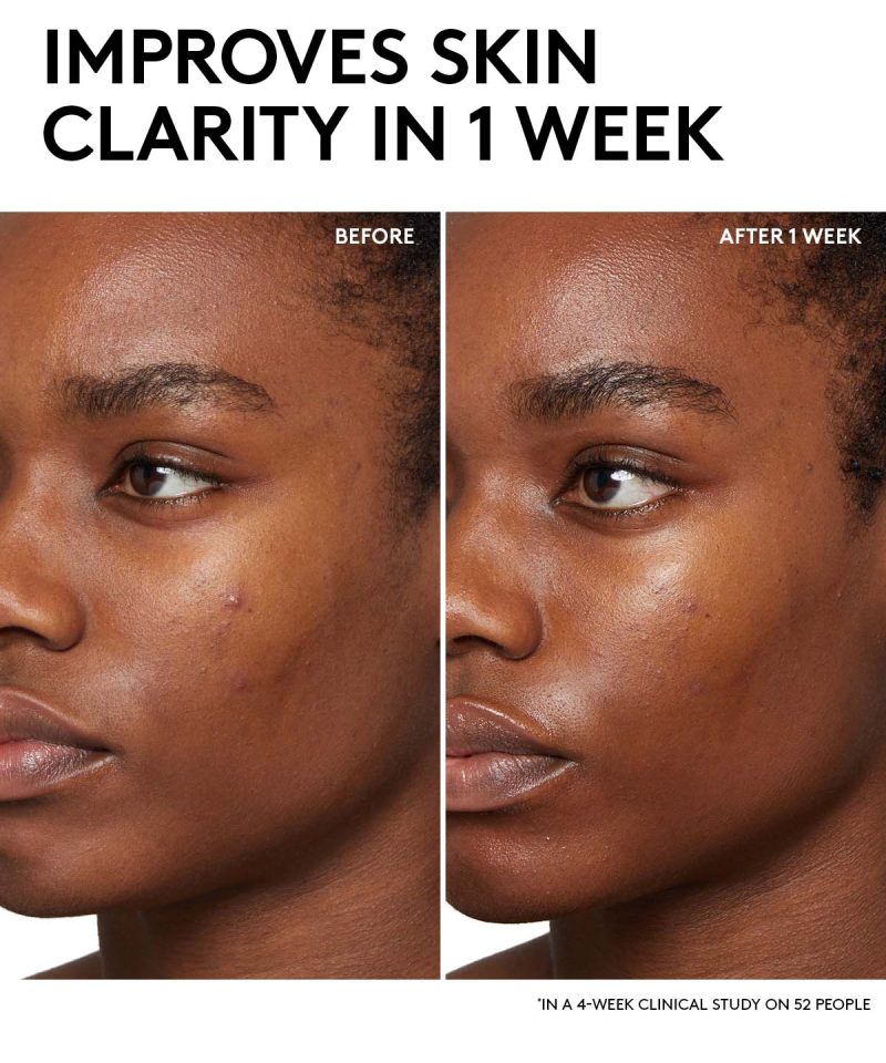 Alternative view of Cherry Dub BHA Toner with Salicylic Acid + Aloe Juice